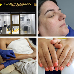 Touch and Glow Beauty Clinic Edgware thumb-129145